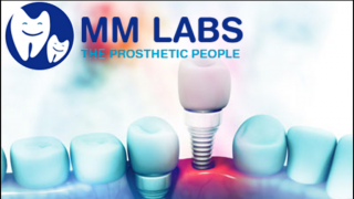 dental laboratory hyderabad MM Dental Lab