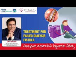 treatment for failed dialysis fistula