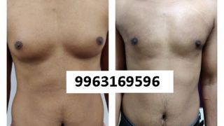 plastic surgeon hyderabad Plastic and Cosmetic Surgeries | Liposuction & Gynecomastia in Hyderabad