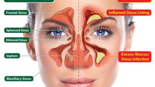 otolaryngology clinic lucknow Dr. Zeeshan ENT Specialist - Shan ENT Clinic