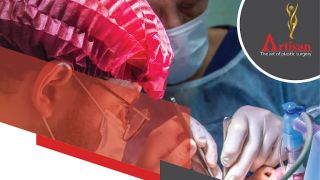 transplant surgeon lucknow ARTISAN:The Art Of Plastic Surgery # Best Hair Transplant Center#Robotic#Power Liposuction#aesthetic excellences